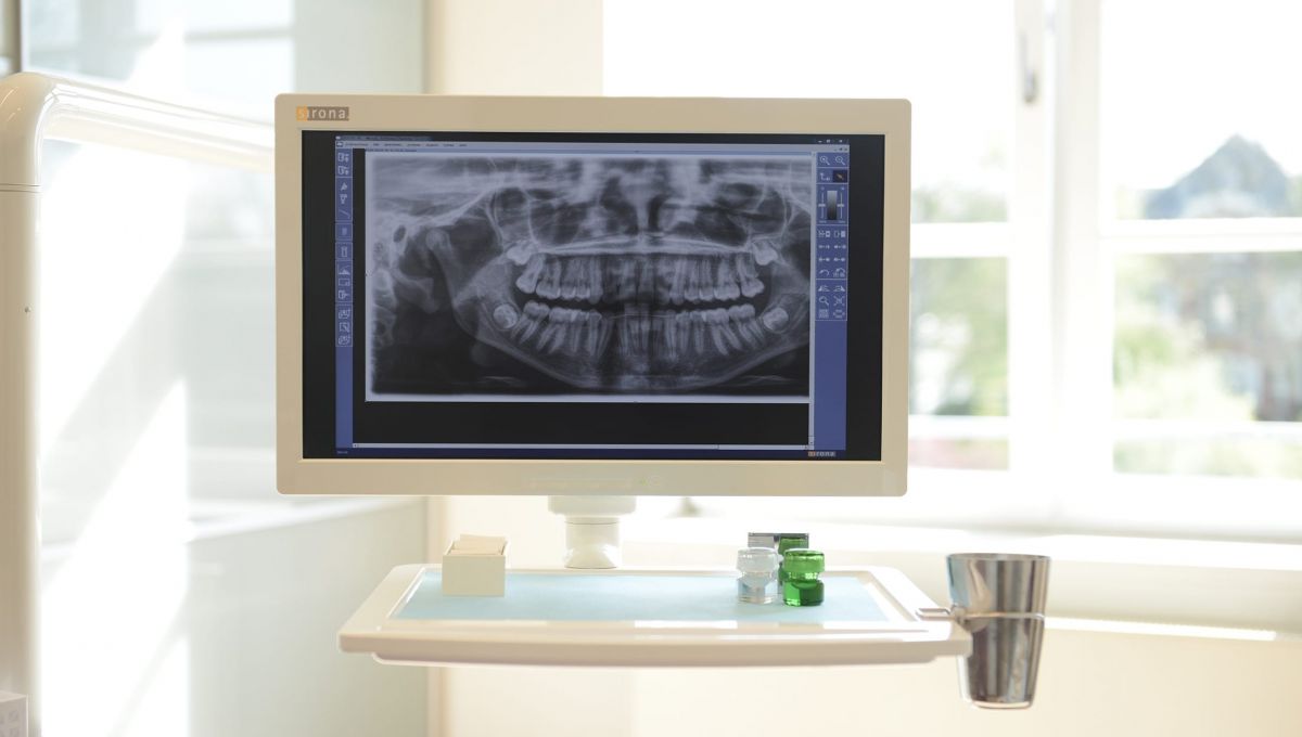 Zahnersatz - Roentgenbild